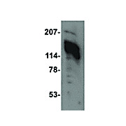 AMBRA1 cterm Antibody 100µg