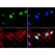 Anti-Histone H3 [Monomethyl Lys18] (RABBIT) Antibody, 50µg, Liquid (sterile filtered)