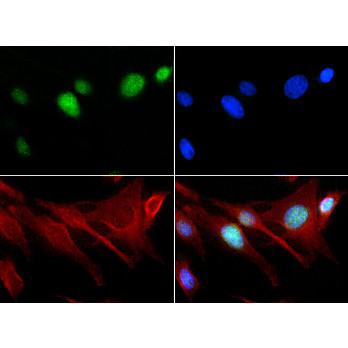 Anti-Histone H3 [Monomethyl Lys18] (RABBIT) Antibody, 50µg, Liquid (sterile filtered)
