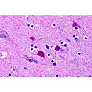BOK Antibody 100µg
