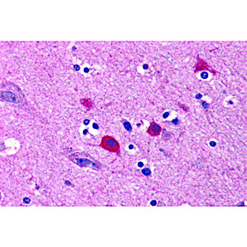 BOK Antibody 100µg