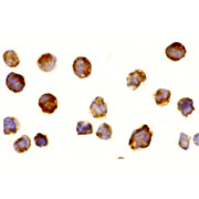 Anti-BTK (RABBIT) Antibody, 100µg, Liquid (sterile filtered)