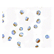 Anti-BUB1 (RABBIT) Antibody, 100µg, Liquid (sterile filtered)