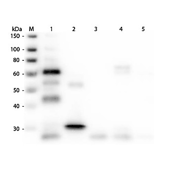 Anti-CHICKEN IgG (H&L) (GOAT) Antibody Rhodamine Conjugated (Min X Bv Gt GP Ham Hs Hu Ms Rb Rt & Sh Serum Proteins), 1mg, Lyophilized