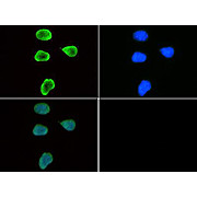 Anti-Histone H3 [Trimethyl Lys9] (RABBIT) Antibody, 50µg, Liquid (sterile filtered)