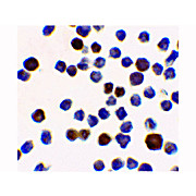 ACINUS cterm hu Acinus-L Antibody 100µg