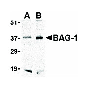 BAG1 cterm Antibody 100µg
