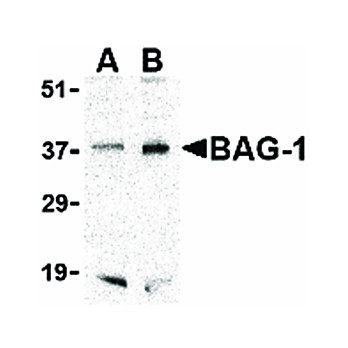 BAG1 cterm Antibody 100µg