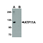 Anti-ATP11A (RABBIT) Antibody, 100µg, Liquid (sterile filtered)