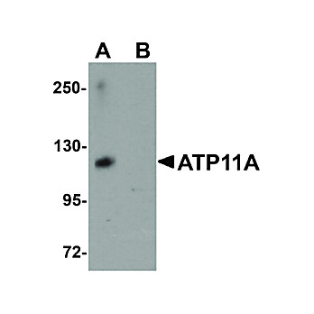 Anti-ATP11A (RABBIT) Antibody, 100µg, Liquid (sterile filtered)