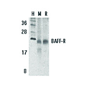 Anti-BAFF Receptor (RABBIT) Antibody, 100µg, Liquid (sterile filtered)