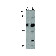 Anti-ACVR1C (RABBIT) Antibody, 100µg, Liquid (sterile filtered)