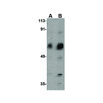 Anti-ACVR1C (RABBIT) Antibody, 100µg, Liquid (sterile filtered)