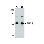 Anti-APC8 (RABBIT) Antibody, 100µg, Liquid (sterile filtered)
