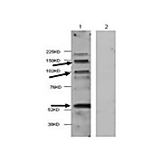HDAC4 (hu internal) Antibody 100µg