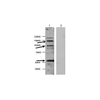 HDAC4 (hu internal) Antibody 100µg
