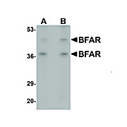 Anti-BFAR (RABBIT) Antibody, 100µg, Liquid (sterile filtered)