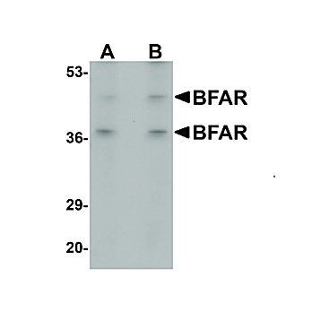Anti-BFAR (RABBIT) Antibody, 100µg, Liquid (sterile filtered)