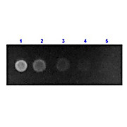 Anti-HUMAN SERUM ALBUMIN (RABBIT) Antibody Fluorescein Conjugated, 1mg, Lyophilized