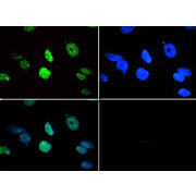 Anti-Histone H3 [Trimethyl Lys18] (RABBIT) Antibody, 50µg, Liquid (sterile filtered)