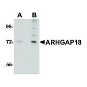 Anti-ARHGAP18 (RABBIT) Antibody, 100µg, Liquid (sterile filtered)