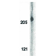 ACINUS - cterm hu Antibody 100µg