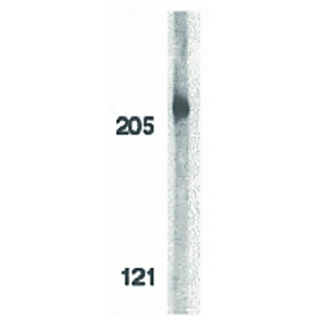 ACINUS - cterm hu Antibody 100µg