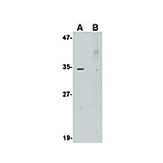 AKIRIN2 Antibody 100µg