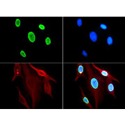 Anti-Histone H3 [ac Lys9] (RABBIT) Antibody, 50µg, Liquid (sterile filtered)