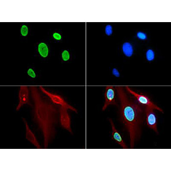 Anti-Histone H3 [ac Lys9] (RABBIT) Antibody, 50µg, Liquid (sterile filtered)