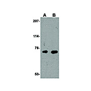 AIFM3 Antibody 100µg