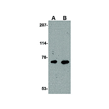 AIFM3 Antibody 100µg