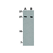 AKIRIN1 nterm Antibody 100µg