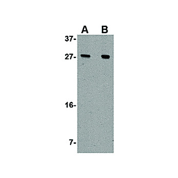 AKIRIN1 nterm Antibody 100µg