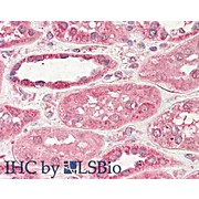 Anti-STIM2 (SHEEP) Antibody, 100µg, Liquid (sterile filtered)