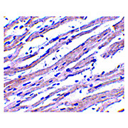 APAF1 nterm Antibody 100µg