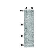 BRCC45 Antibody 100µg
