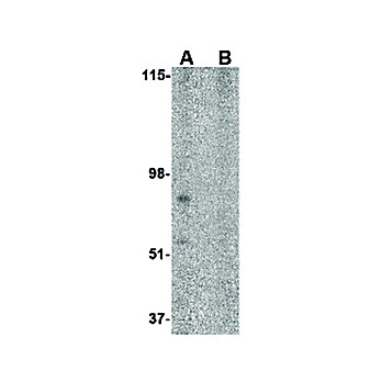 BRCC45 Antibody 100µg