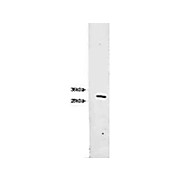 Anti-RFP (CHICKEN) Antibody, 100µg, Liquid (sterile filtered)