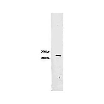 Anti-RFP (CHICKEN) Antibody, 100µg, Liquid (sterile filtered)