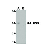 ABIN3 Antibody 100µg
