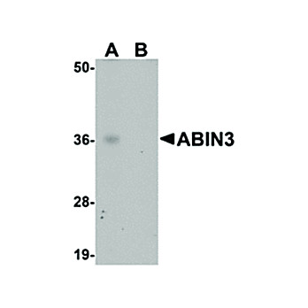 ABIN3 Antibody 100µg