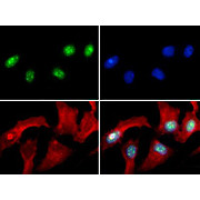 Anti-Histone H3 [Asym-dimethyl Arg8] (RABBIT) Antibody, 50µg, Liquid (sterile filtered)