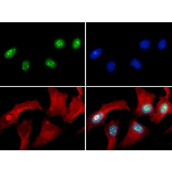 Anti-Histone H3 [Asym-dimethyl Arg8] (RABBIT) Antibody, 50µg, Liquid (sterile filtered)