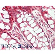 Anti-STIM1 (RABBIT) Antibody, 100µg, Liquid (sterile filtered)