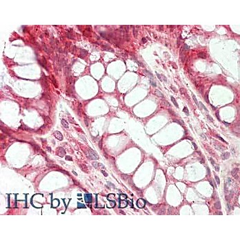 Anti-STIM1 (RABBIT) Antibody, 100µg, Liquid (sterile filtered)