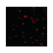 BRSK1 cterm Antibody 100µg