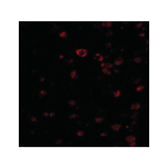 BRSK1 cterm Antibody 100µg