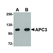 Anti-APC3 (RABBIT) Antibody, 100µg, Liquid (sterile filtered)