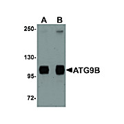 Anti-ATG9B (RABBIT) Antibody, 100µg, Liquid (sterile filtered)